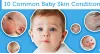 Common Newborn Skin Problems and Solutions