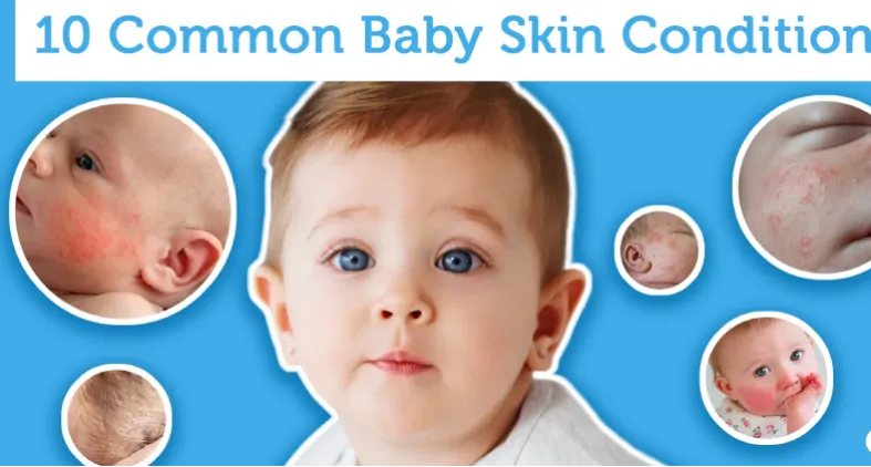 Common Newborn Skin Problems and Solutions